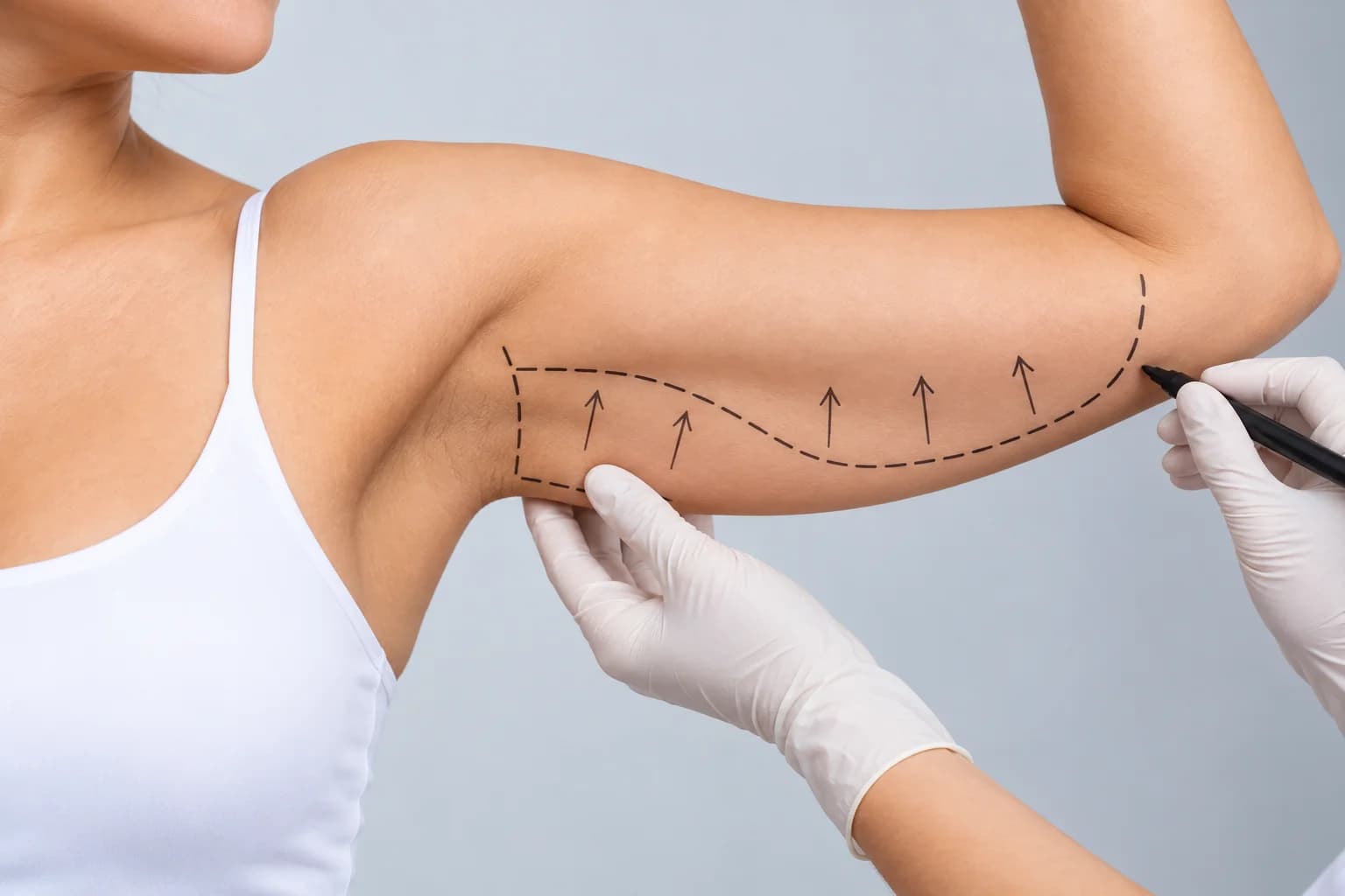 Arm lift brachioplasty at Cosmetic Krafts